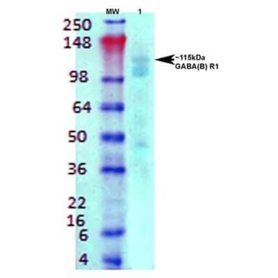 Western Blot: GABA-B R1 Antibody (S93A-49) [NBP2-59336]