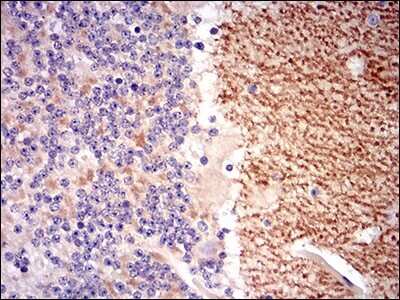 Immunohistochemistry-Paraffin: GABA-B R2 Antibody (5G7B9) - BSA Free [NBP2-37280]