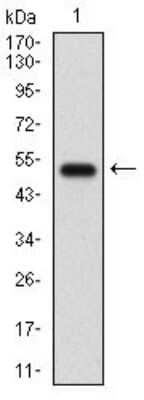 Western Blot: GABA-B R2 Antibody (5G7B9)BSA Free [NBP2-37280]