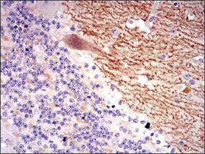 Immunohistochemistry: GABA-B R2 Antibody (5G7F7) - BSA Free [NBP2-37281]