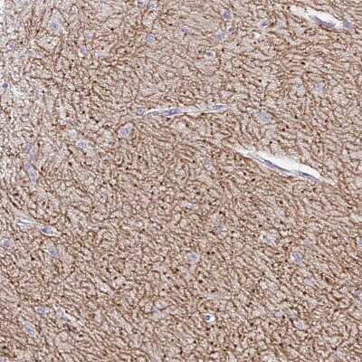 Immunohistochemistry-Paraffin: GABA-B R2 Antibody [NBP1-89803]