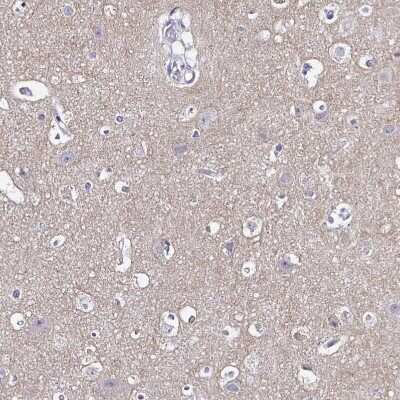Immunohistochemistry-Paraffin: GABA-B R2 Antibody [NBP1-89803]