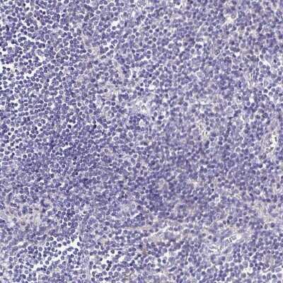 Immunohistochemistry-Paraffin: GABA-B R2 Antibody [NBP1-89803]