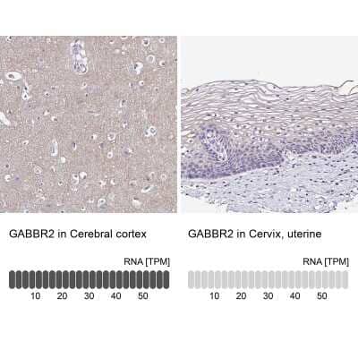 Immunohistochemistry-Paraffin: GABA-B R2 Antibody [NBP1-89803]