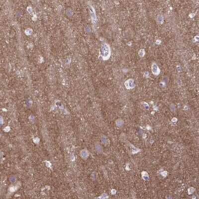 Immunohistochemistry-Paraffin: GABA-B R2 Antibody [NBP2-48516]