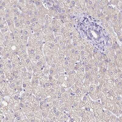 Immunohistochemistry-Paraffin: GABA-B R2 Antibody [NBP2-48516]