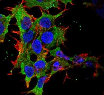 Immunocytochemistry/ Immunofluorescence: GABA-B R2 Antibody (S81-2) [NBP2-59335]