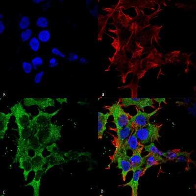 Immunocytochemistry/ Immunofluorescence: GABA-B R2 Antibody (S81-2) [NBP2-59335]