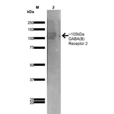 Western Blot: GABA-B R2 Antibody (S81-2) [NBP2-59335]