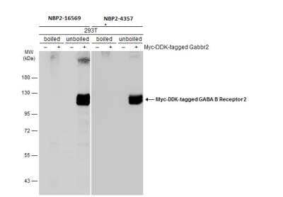 Western Blot: GABA-B R2 Antibody [NBP2-16569]