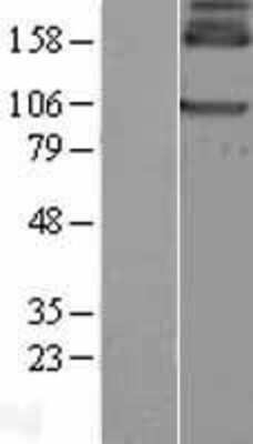 Western Blot: GABA-B R1 Overexpression Lysate [NBL1-10908]