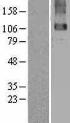 Western Blot: GABA-B R2 Overexpression Lysate [NBL1-10910]