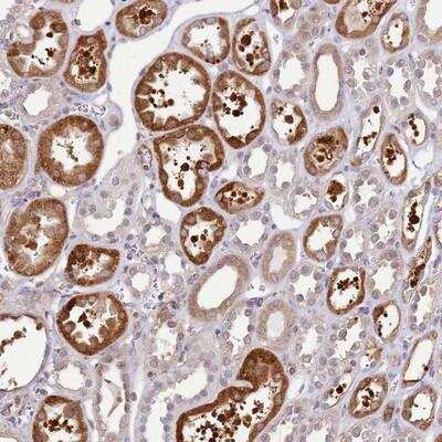 Immunohistochemistry-Paraffin: GABA Receptor Epsilon Antibody [NBP1-91919]