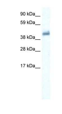 Western Blot: GABA Receptor Epsilon Antibody [NBP1-80081]