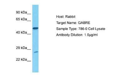 Western Blot: GABA Receptor Epsilon Antibody [NBP1-80081]