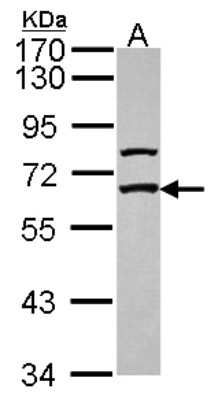 Western Blot: GABA Receptor Epsilon Antibody [NBP2-21572]