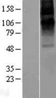 Western Blot: GABA Receptor Epsilon Overexpression Lysate [NBL1-10924]