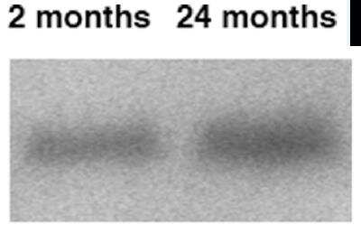 Western Blot: GABA Transporter 2 Antibody [NB100-1872]