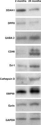 Western Blot: GABA Transporter 2 Antibody [NB100-1872]