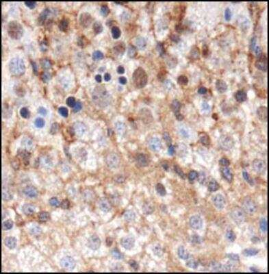 Immunohistochemistry: GABARAP Antibody - BSA Free [NBP1-97416]