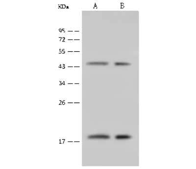 Western Blot: GABARAP Antibody [NBP2-99474]