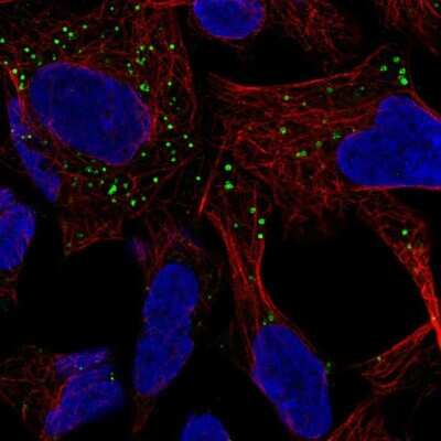 Immunocytochemistry/ Immunofluorescence: GABARAPL1 Antibody [NBP2-57635]