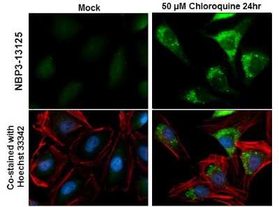 Immunocytochemistry/ Immunofluorescence: GABARAPL1 Antibody [NBP3-13125]