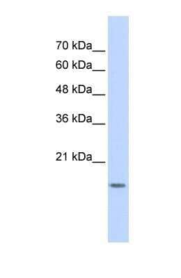 Western Blot: GABARAPL1 Antibody [NBP1-55203]