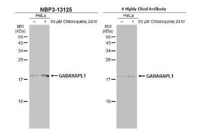 Western Blot: GABARAPL1 Antibody [NBP3-13125]