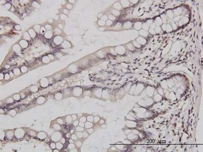 Immunohistochemistry-Paraffin: GABPA Antibody (1D6) [H00002551-M04]