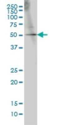 Western Blot: GABPA Antibody (1D6) [H00002551-M04]