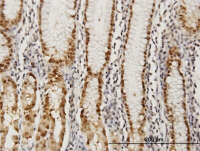 Immunohistochemistry-Paraffin: GABPA Antibody (5C8) [H00002551-M07]