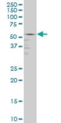 Western Blot: GABPA Antibody (5C8) [H00002551-M07]