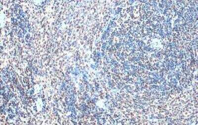 Immunohistochemistry-Paraffin: GABPA Antibody [NBP1-32105]