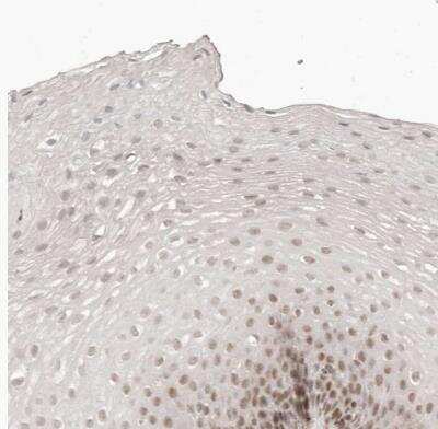 Immunohistochemistry-Paraffin: GABPA Antibody [NBP1-84941]