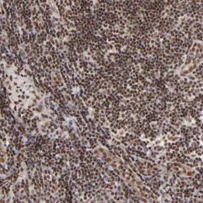 Immunohistochemistry-Paraffin: GABPA Antibody [NBP1-84942]