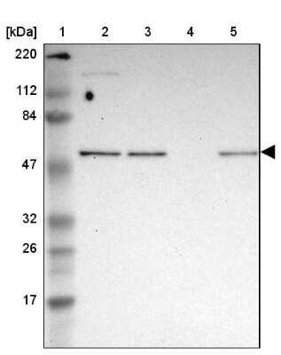 Western Blot: GABPA Antibody [NBP1-84942]