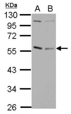 Western Blot: GABPA Antibody [NBP2-16570]