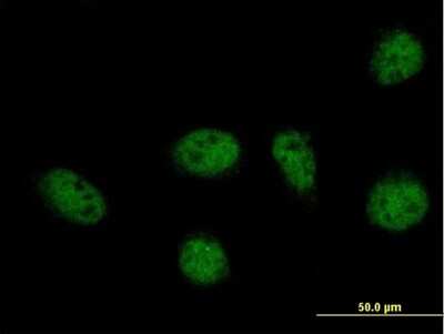 Immunocytochemistry/ Immunofluorescence: GABPB1 Antibody [H00002553-B01P]