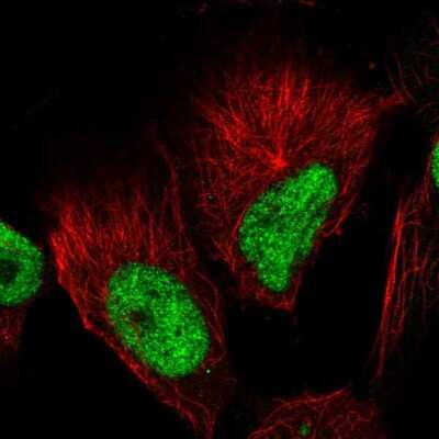 Immunocytochemistry/ Immunofluorescence: GABPB1 Antibody [NBP2-55876]