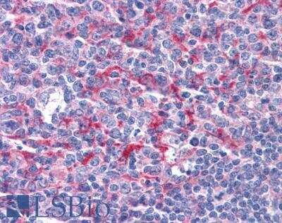 Immunohistochemistry-Paraffin: GABPB1 Antibody [NB100-60948]