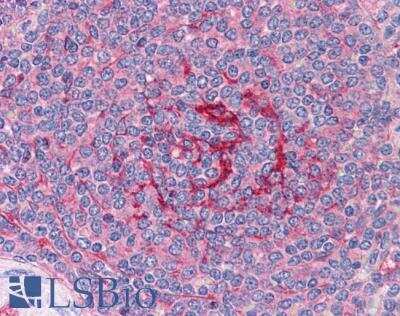 Immunohistochemistry-Paraffin: GABPB1 Antibody [NB100-60948]
