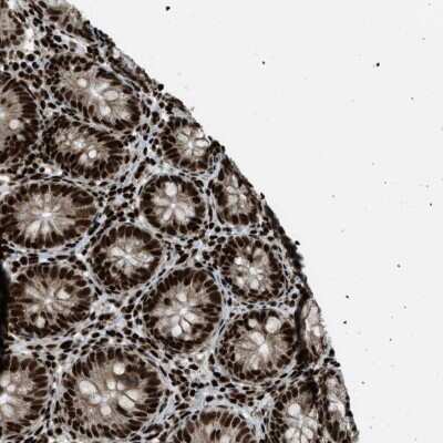 Immunohistochemistry-Paraffin: GABPB1 Antibody [NBP1-84028]