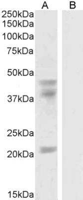 Western Blot: GABPB1 Antibody [NB100-60948]