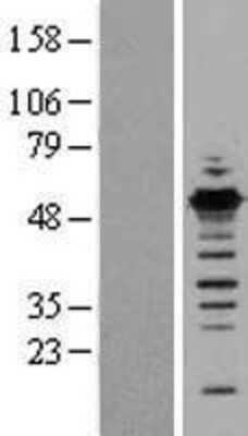 Western Blot: GABPB1 Overexpression Lysate [NBL1-10912]