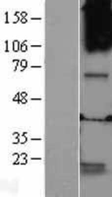 Western Blot: GABA-A R theta Overexpression Lysate [NBL1-10931]