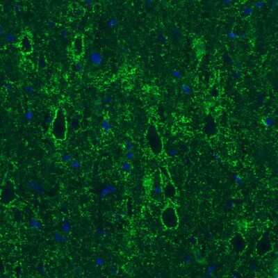 Immunohistochemistry: GAD1/GAD67 Antibody (CL2911) [NBP2-46637]