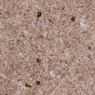 Immunohistochemistry-Paraffin: GAD1/GAD67 Antibody (CL2911) [NBP2-46637]