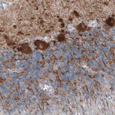 Immunohistochemistry-Paraffin: GAD1/GAD67 Antibody (CL2911) [NBP2-46637]