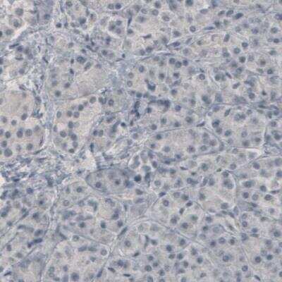 Immunohistochemistry-Paraffin: GAD1/GAD67 Antibody (CL2911) [NBP2-46637]